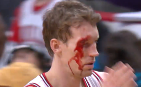 Mike Dunleavy Leaves Bloody, Returns a Beast