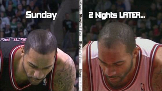Carlos Boozer Explains the Time He Painted His Hair